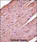 Mouse Pdk3 Antibody (C-term)